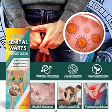 Genital Wart Removal Cream 20g Skin Treatment Wart Remover Fast Acting USA