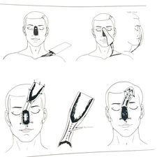 Upper Extremities Grabb's Encyclopedia of Flaps Lot of 2 Books Hardcover 1990