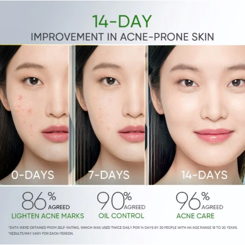 SKINTIFIC 3X 酸抗痤疮凝胶保湿霜 30 克 — 第 3/4 张图片