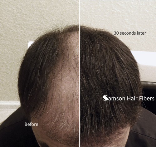 Samson Best Hair Loss Concealer Building Fibers MEDIUM BROWN 50g Refill USA - Picture 4 of 7