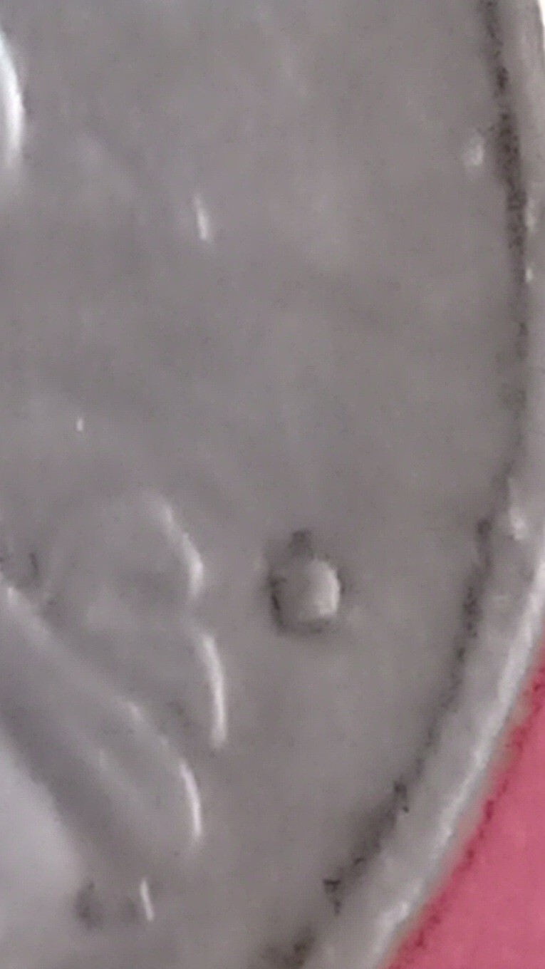 Picture 15 of 18
