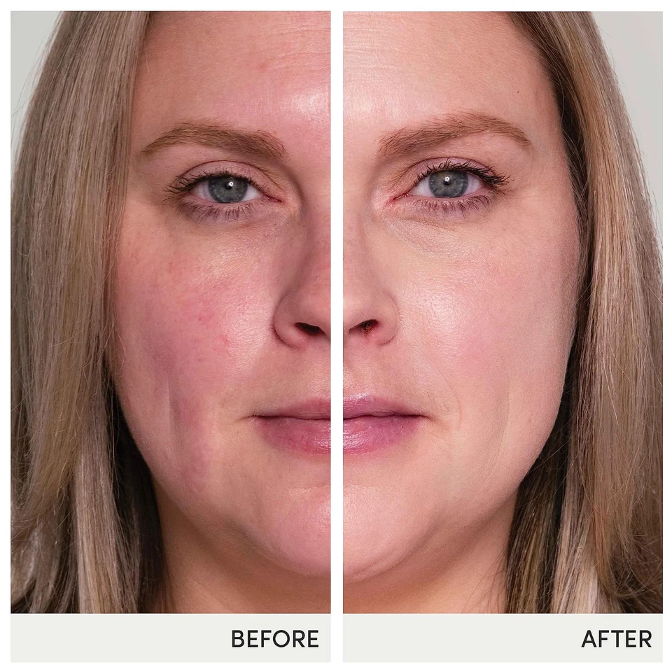 HydroPure Suero Corrector de Color Suero Corrector de Color Líquido 1 Fl Oz Foto 3 de 4