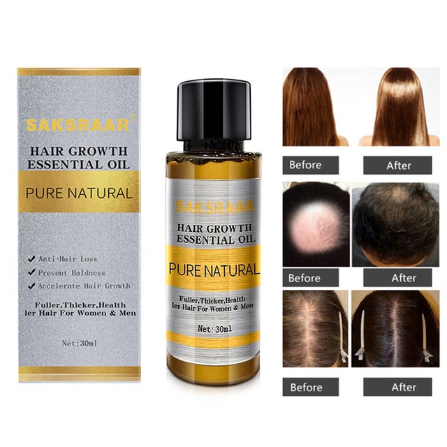 30ml Natural Ginger Germinal Hair Growth Serum Loss Treatment Oil For Men Women For Sale Online Ebay