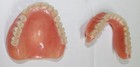 Vintage False Teeth Lot Dentures Upper, Partial And Lowers Medical Oddity Scrap — photo 2