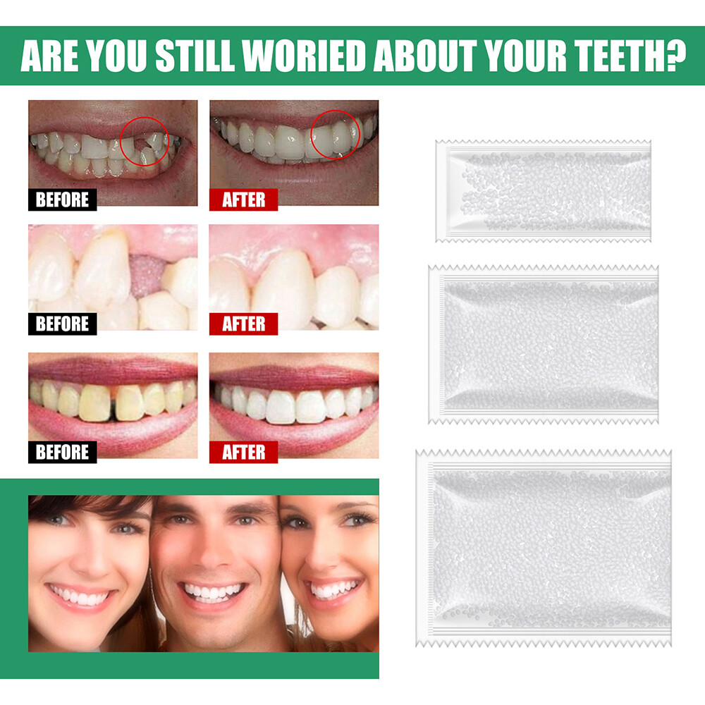 Temporary Tooth Repair Kit Teeth Solid Glue Denture Adhesive Whitening  -