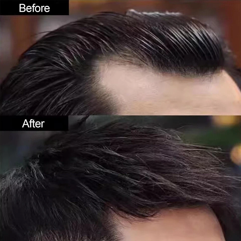 Parche para cabello de punto calvo Toupee base completa de piel de PU encubrimiento parches para cabello humano Remy Foto 4 de 4