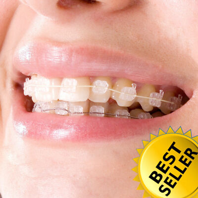 Dental Orthodontic Metal Self-ligating Ceramic Clear Crystal Brackets Braces ALL