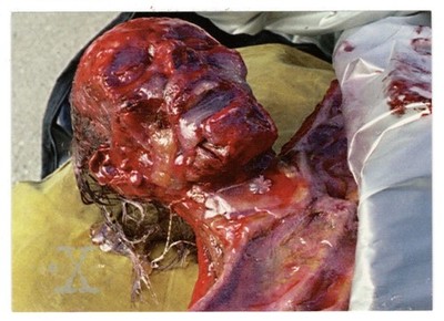 Emulsified Remains (Trading Card) X-Files - Season 3 - 1996 Topps # 43 - Mint