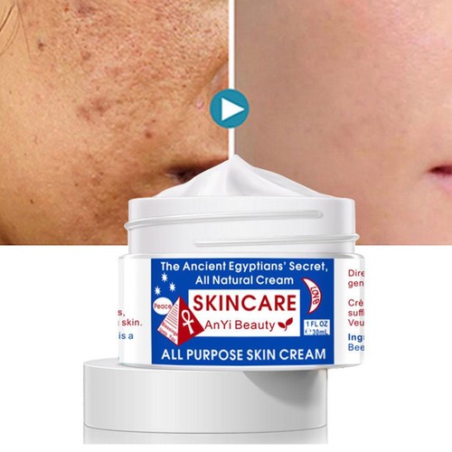 30ml Egyptian Magic All Purpose Skin Cream 🥇DE - Bild 6 von 12