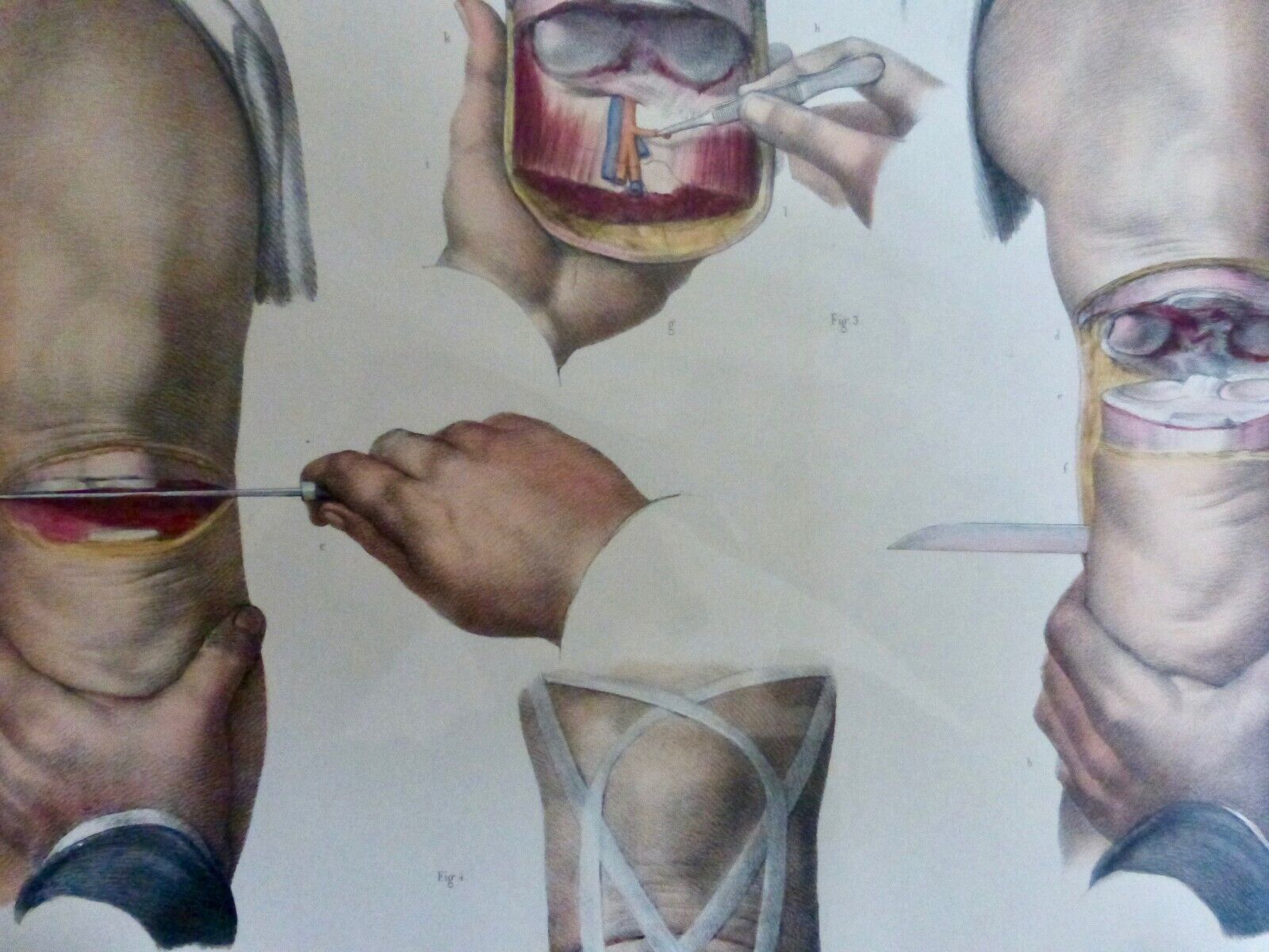 Imagen 2 de 3