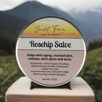 Rosehip Salve ORGANIC HERBAL Ointment Jojoba Healthy Skin All Natural 2 oz U.S.