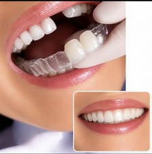 Retainer With Teeth, Affordable Way To Fill In Your Smile, can add 1-4 Teeth.