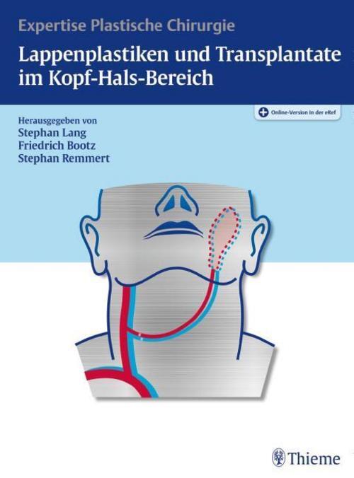 Stephan H. Lang Lappenplastiken Und Transplantate Kopf-ha ...