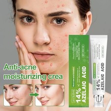 Black New Acne Formation 14 AzelaicAcid Anti-acne Moi sturizing Cream30ml V2J5