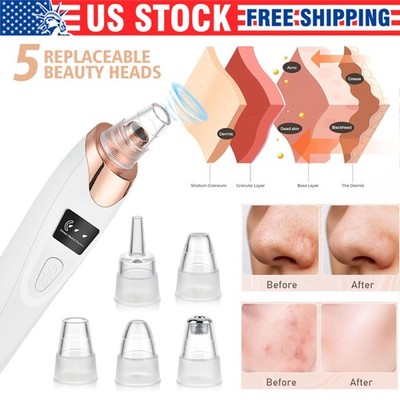 Blackhead Remover Electric Pore Nose Sucker Pimple Skin Acne Face cleaner Vacuum