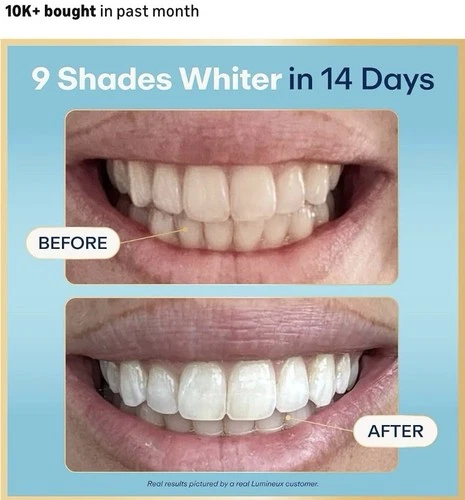 Lumineux Teeth Whitening Strips - Thumbnail 5