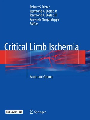 Robert S. Dieter (u. a.) | Critical Limb Ischemia | Taschenbuch | Englisch