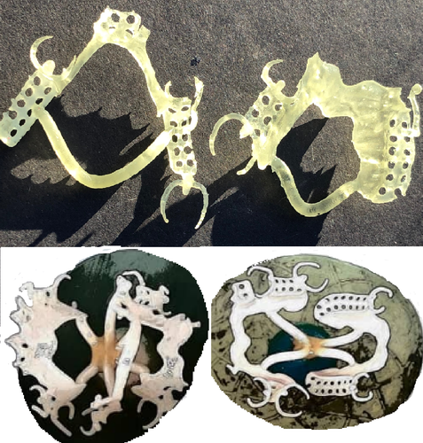 ALPHASENSE 3D CASTABLE RESIN FOR DENTAL AND JEWELRY APPLICATIONS(500ML) - 第 8/11 張圖片