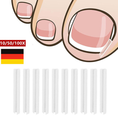 Eingewachsener Nagel Pad Groove Fußpflege Tool Zehennagel Korrektor Pediküre-DE