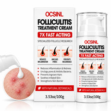 Folliculitis Cream 5 Benzoyl Peroxide Scalp Body Care