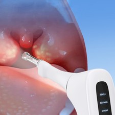 New Electric Vacuum Tonsil Stone Removal Kit Vacuum Irrigation Syringe Oral Care