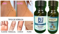 Quita Verrugas Skin Tag Remover Saniskin Sani Skin Piel Homeopathic Natural Quita Verrugas Skin Tag Remover Saniskin Sani Skin Piel Homeopathic Natural