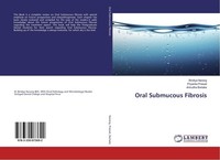 Oral Submucous Fibrosis Bindiya Narang
