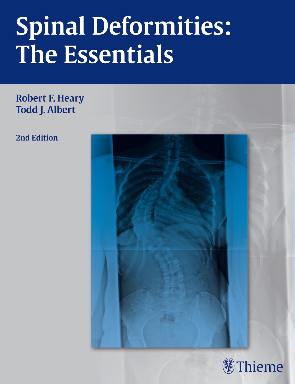 Thumbnail - Spinal Deformities The Essentials Robert F Heary (u. A.) Buch 261 S.