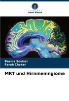 MRT Und Hirnmeningiome Basma Souissi (U. A.) Taschenbuch Englisch 2025