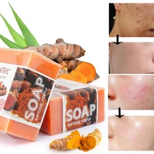 Tumeric Soap Ginger Anti-Acne Dark Spots Removal  Skin Glow, Brighter Skin US