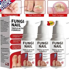 Fungi-Nail Anti-Fungal Liquid Solution Kills Fungus That Can Lead To Nail