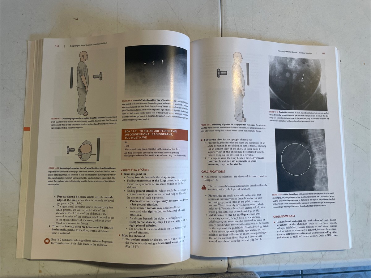Learning Radiology: Recognizing the Basics， 3e Herring MD  FACR， William Learning Radiology: Recognizing the Basics: 9780323328074
