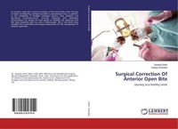Surgical Correction Of Anterior Open Bite Sanjana Sethi