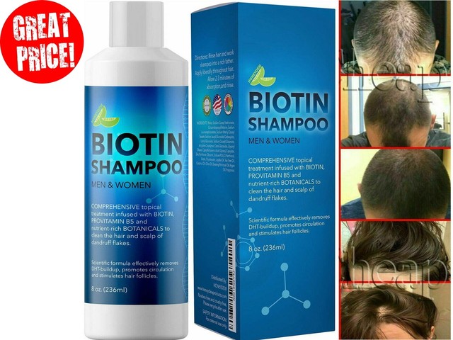 shampoo biotin para el crecimiento de cabello