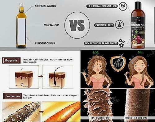 Luxura Sciences Onion Hair Oil with 14 Essential Oils for Hair Growth 250ml