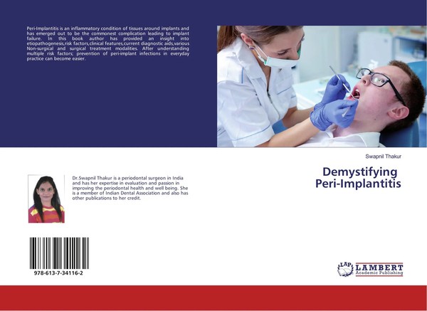 Swapnil Thakur | Demystifying Peri-Implantitis | Taschenbuch | Englisch (2018)-image