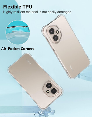 Foluu Cover trasparente per Honor 400 – Custodia protettiva