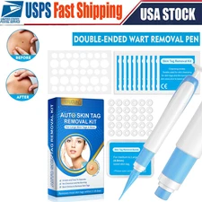 Auto Micro Skin Tag Remover Device Kit Painless Removal Wart Removal Pen Set