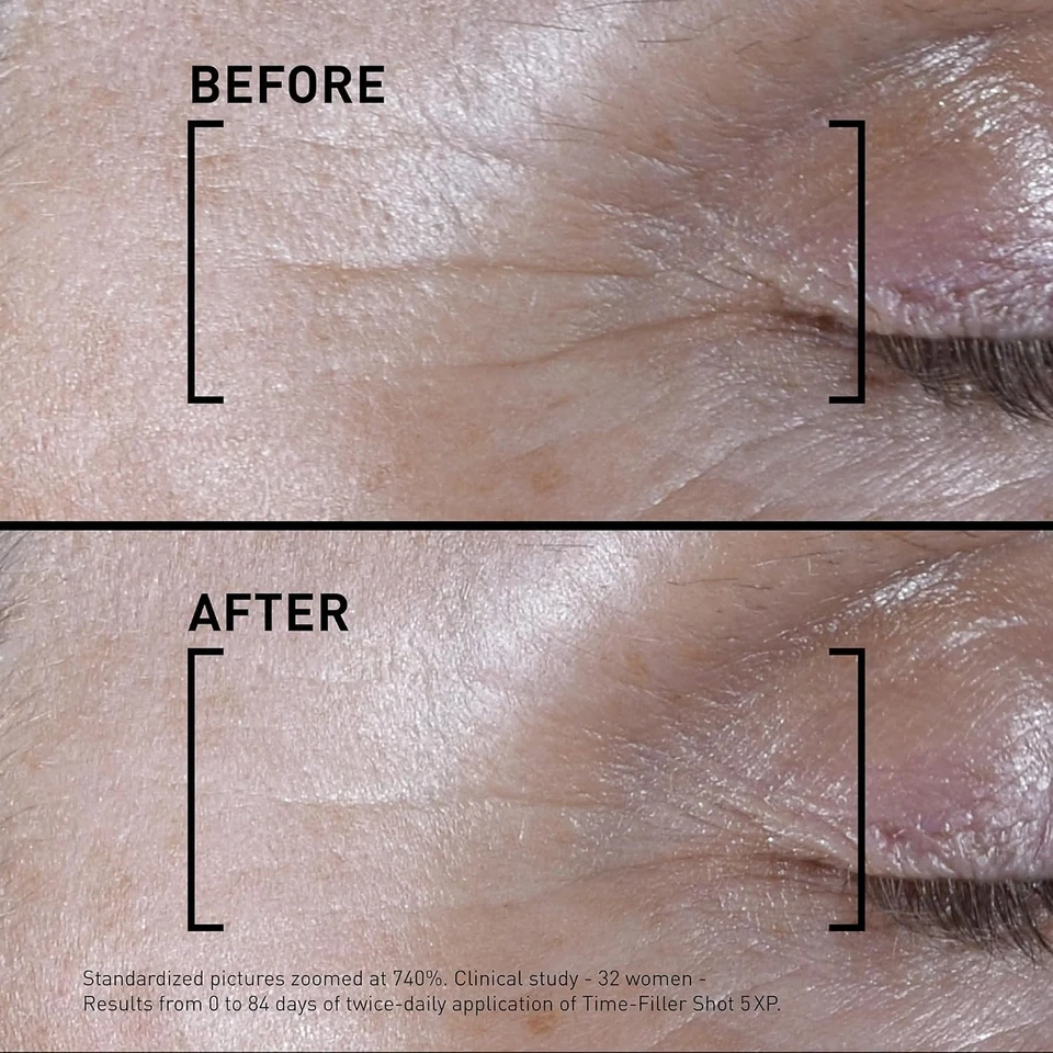 Filorga Time-Filler Shot, A Moisturizing Serum with Neuropeptide Te0.5 oz No Box - Image 4 of 4