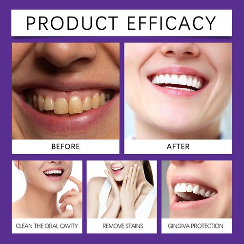 Teeth Cleaning Powder Professional Tooth Shine Powder Natural Whiting attractive - Picture 9 of 12