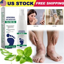 2025 New Foot Sanitizer Spray with Tea Tree Oil, Tea Tree Oil Foot Spray 100ml