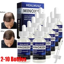 2-10 Pack Minoxidil 5% Extra Strength Men 10 Month Supply Hair Regrowth Solution