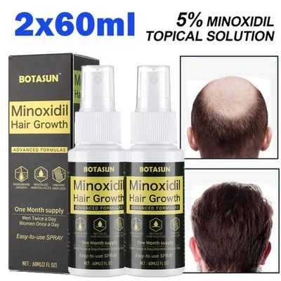 BOTASUN 2 Months Minoxidil 5% Extras Strength Regrowth Treatment Serum Hair Growth Spray