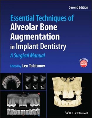 Essential Techniques of Alveolar Bone Augmentation in Implant Dentistry : A S...