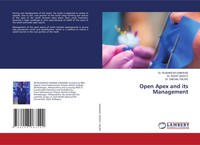 Open Apex And Its Management Rushikesh Gaikwad (U. A.) Taschenbuch Englisch 2024