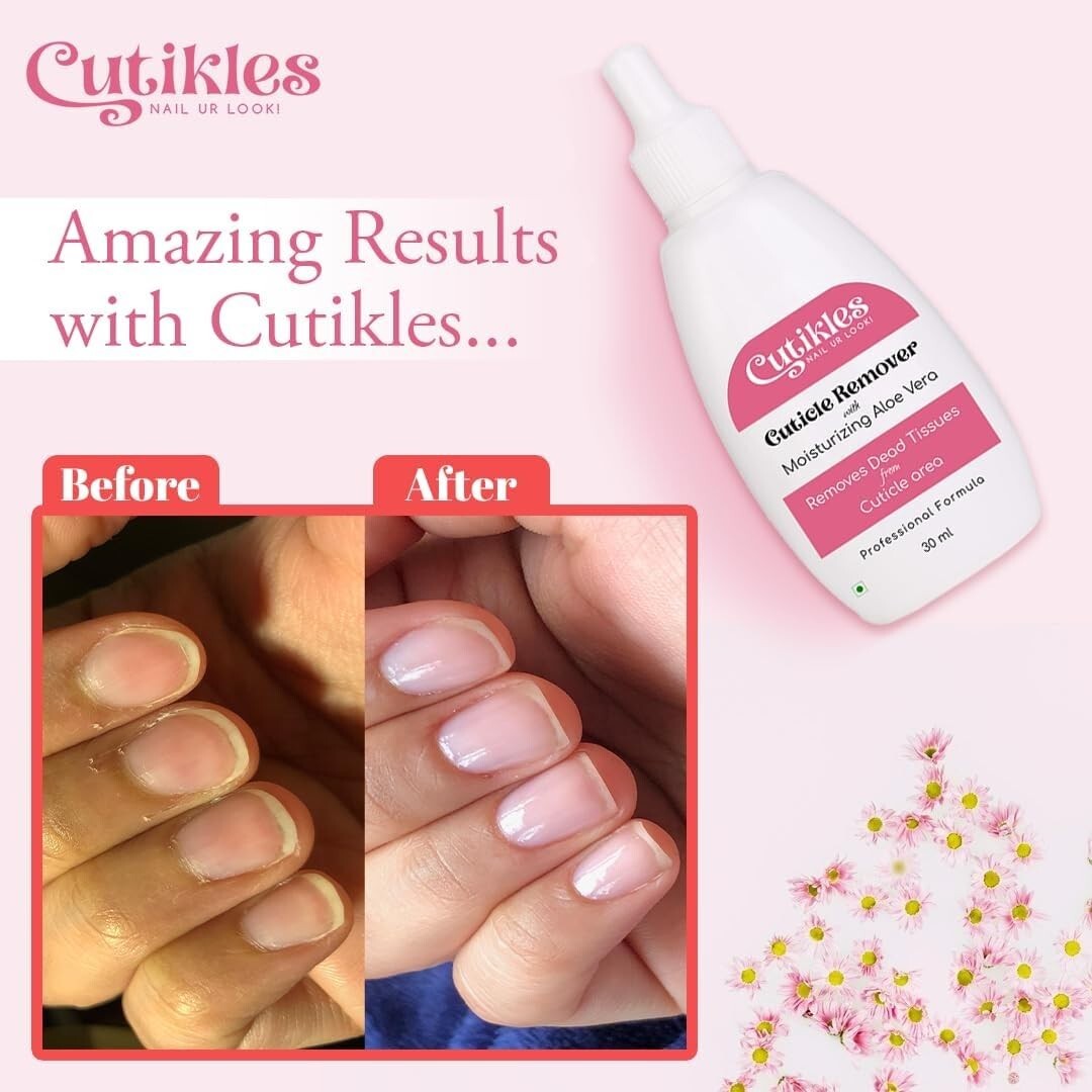 CUTIKLES Cuticle Remover Gel with Moisturizing Aloe Vera. Removes Dead &  Overgro | eBay