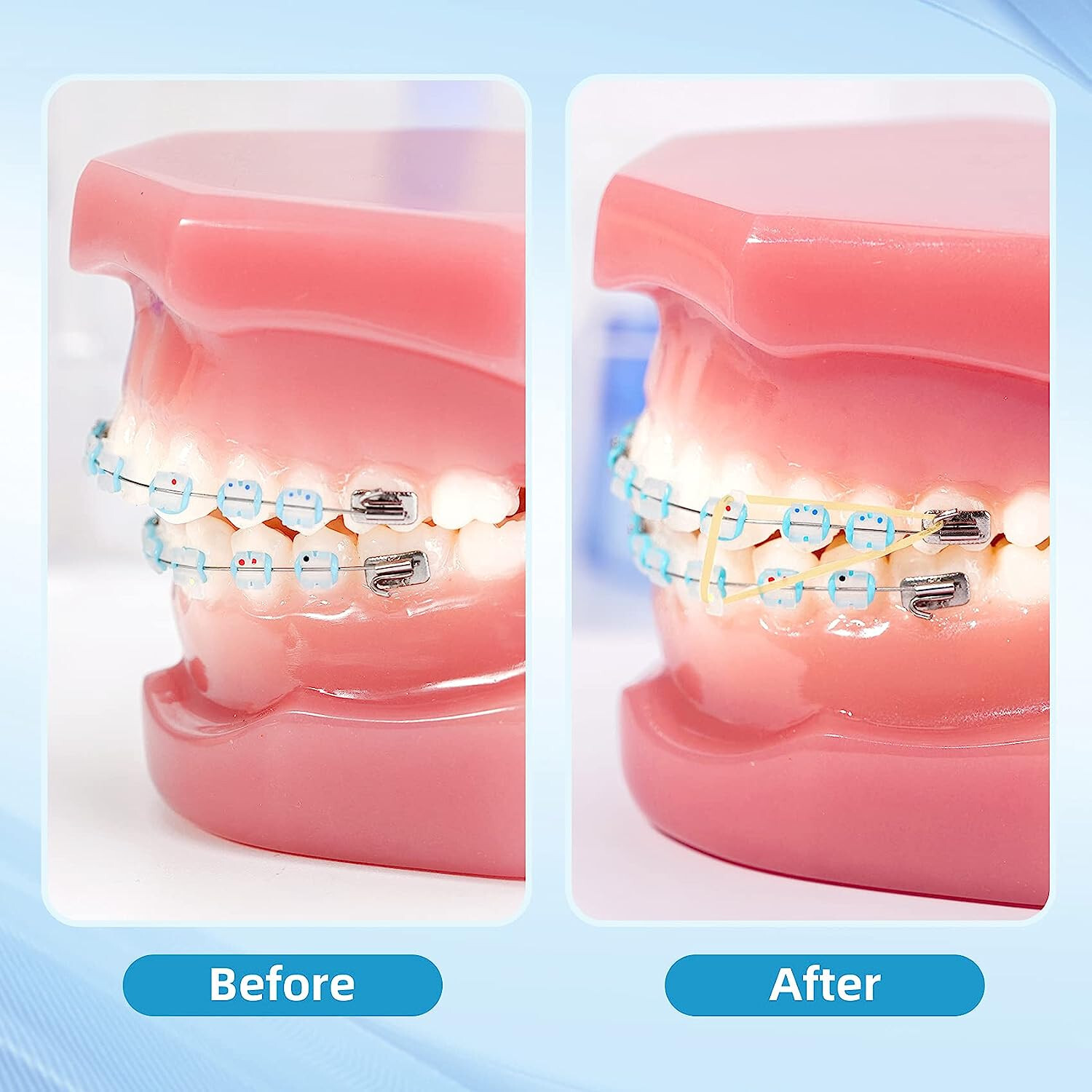 100pcs Dental Orthodontic Elastics LATEX Bands Braces 1/8 5.0oz Chipmunk eBay