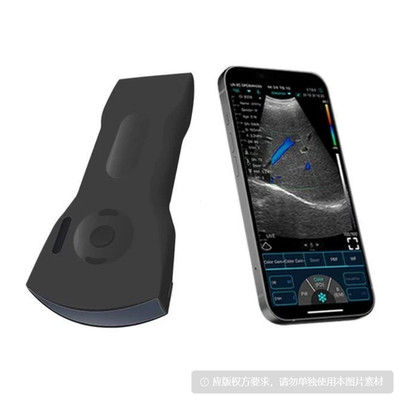 256E 3-in-1 Wireless Color Ultrasound Scanner | 64 Channels Wifi Doppler