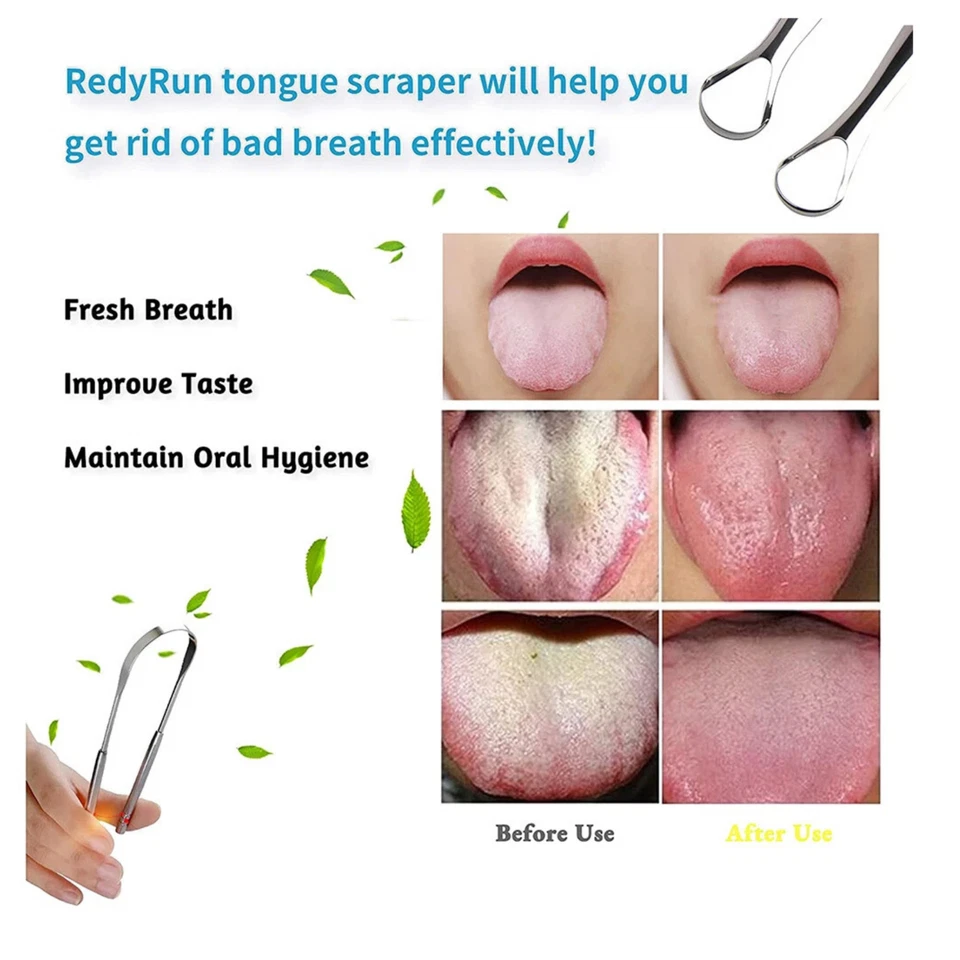 2X Stainless Steel Tongue Lounge Cleaner Scraper Dental Care Hygiene Oral Mouth - Bild 3 von 4