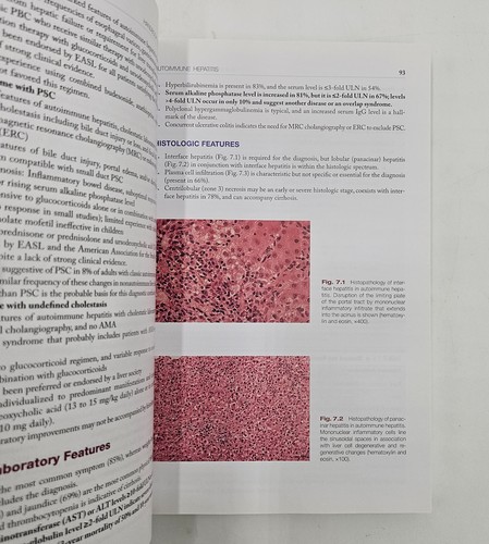 Handbook of Liver Disease 4th Ed by Friedman & Martin | Hepatology GI | PB VG - Picture 12 of 17